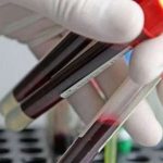 WBC (лейкоциты): диагностика и расшифровка анализа крови, нормы у женщин