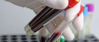 WBC (лейкоциты): диагностика и расшифровка анализа крови, нормы у женщин