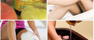 Яблочный уксус при варикозе