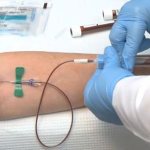 Забор крови из вены