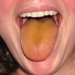 Желтый язык