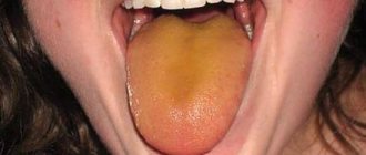 Желтый язык