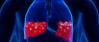 Жидкость в легких. Причины, почему скапливается, как откачивают, лечение и последствия